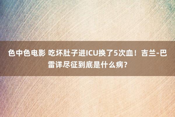 色中色电影 吃坏肚子进ICU换了5次血！吉兰-巴雷详尽征到底是什么病？